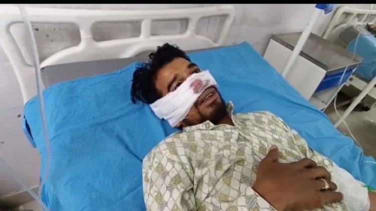 ससुराल वालों ने दामाद की काटी नाक युवक के भाई ने कराया मामला दर्ज