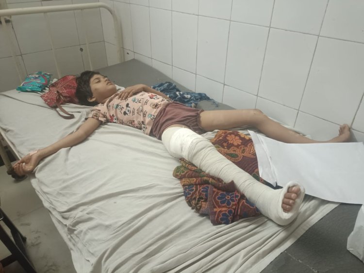 बाइक सवार ने बालिका को मारी टक्कर पैर की टूटी हड्डी मोके से हुवा फरार 