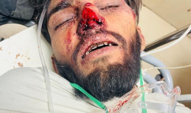 युवती को भगाने वाले युवक पर हमला