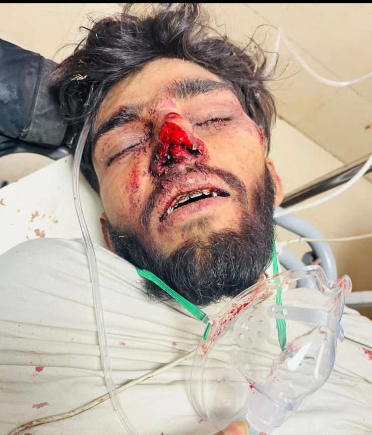 युवती को भगाने वाले युवक पर हमला