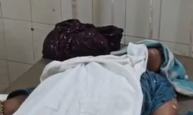 महिला ने आग लगाकर ख़ुदकुशी का किया प्रयास       