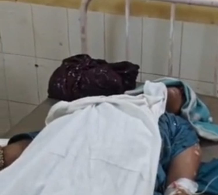 महिला ने आग लगाकर ख़ुदकुशी का किया प्रयास       